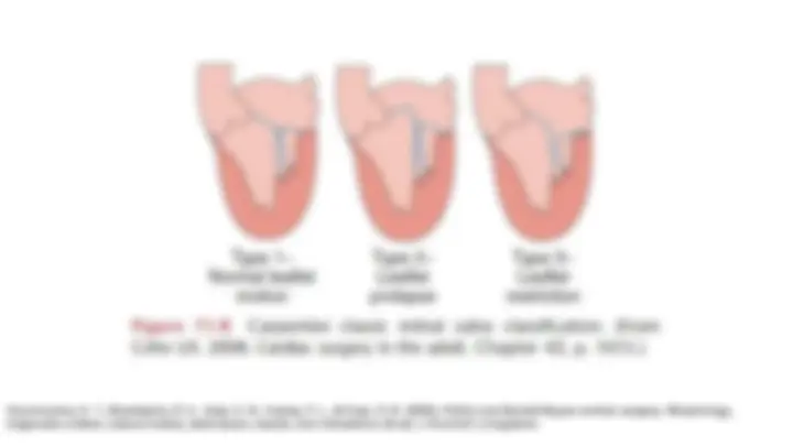 pfe