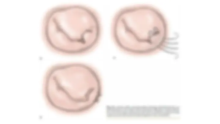 pf3e