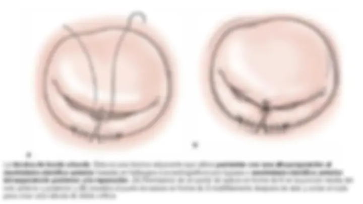 pf5b