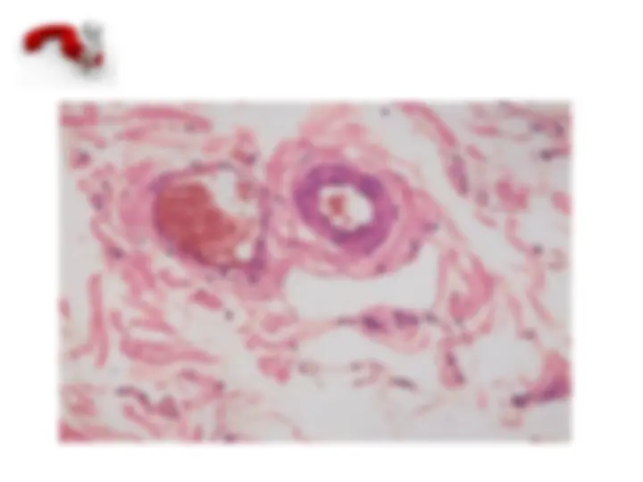 pf28