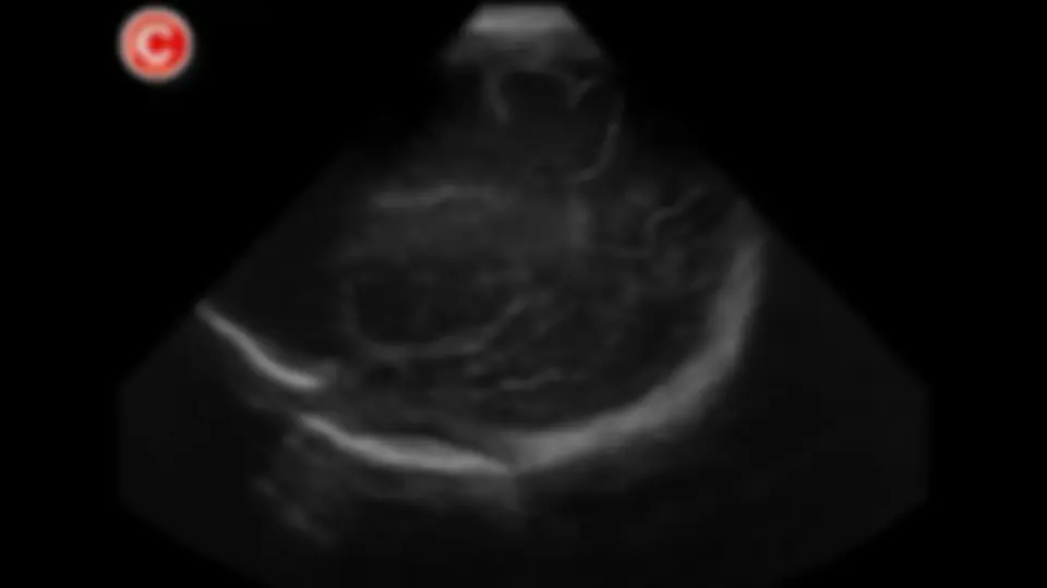 pf2f