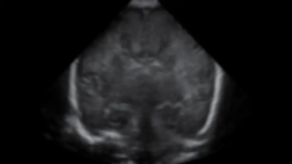 pf63