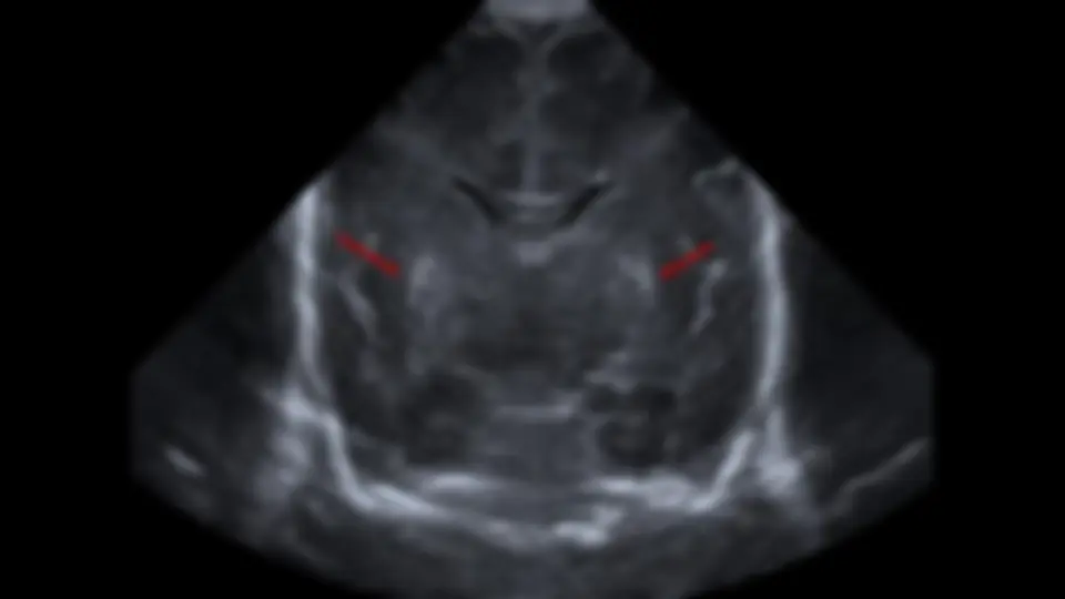 pf44