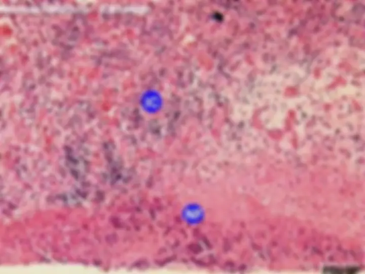 pf49