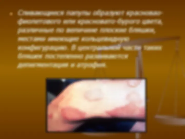 pf16