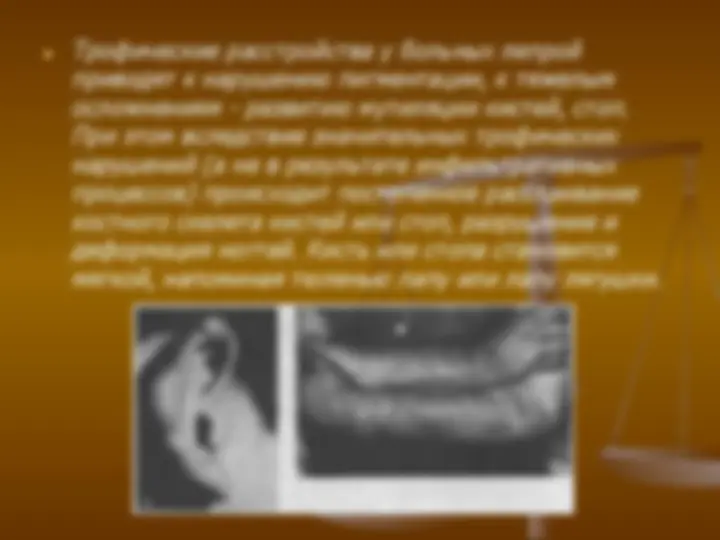 pf13