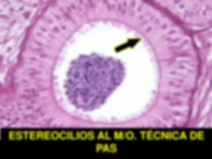 pf20