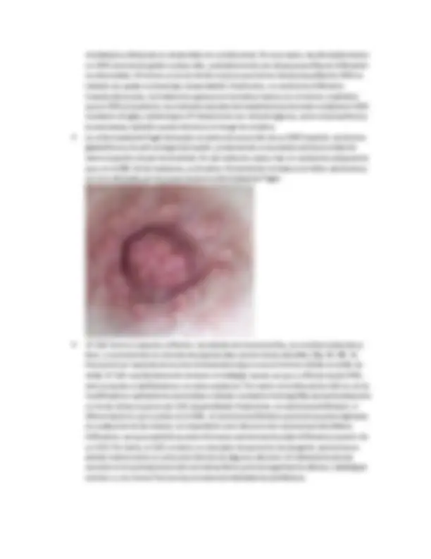 pf5