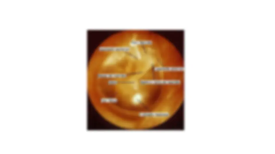 pf5