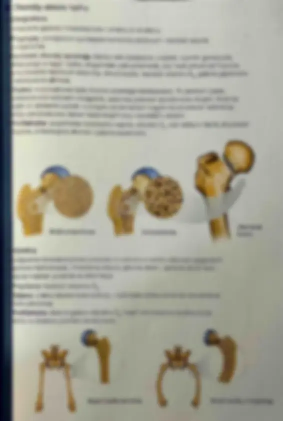 pfa