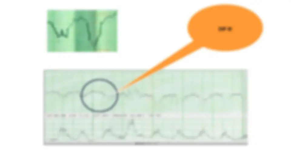 pf48