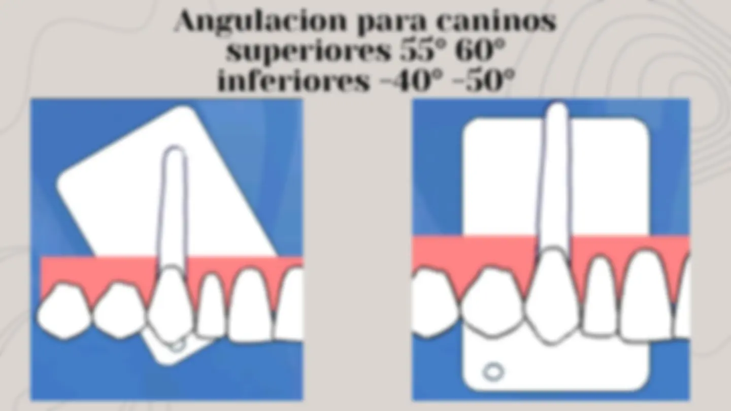 pf38