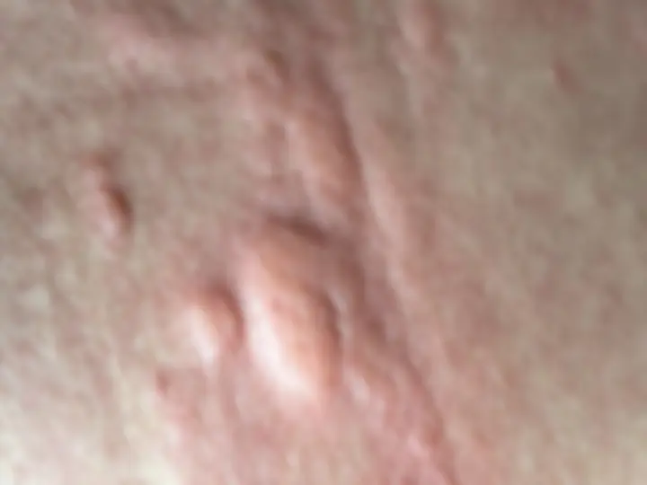 pf1a