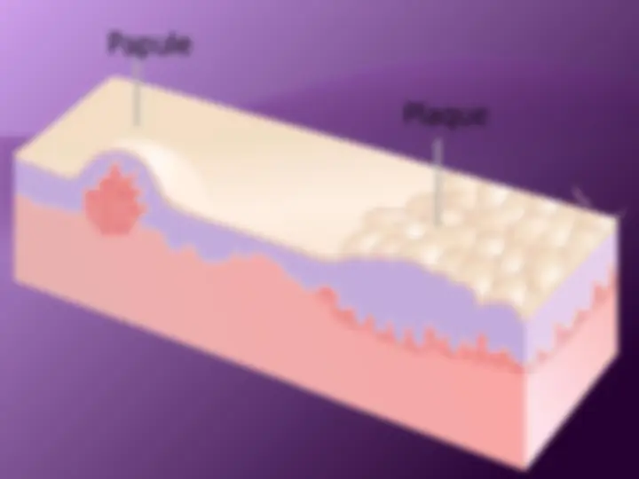 pf14