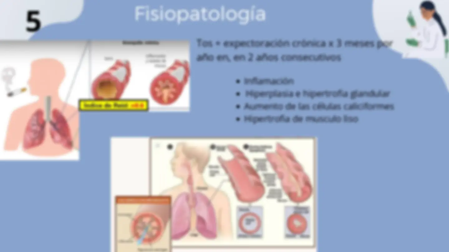 pfa