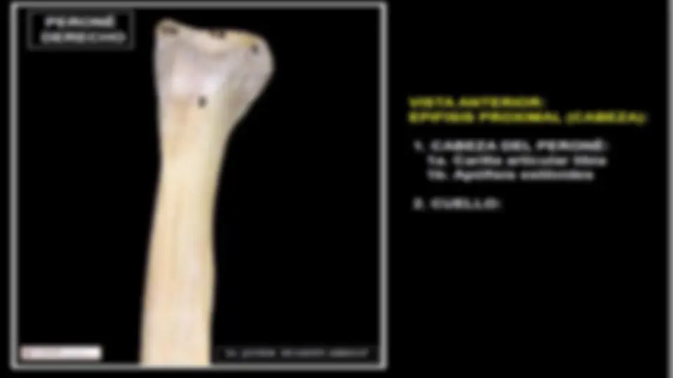 pf3a