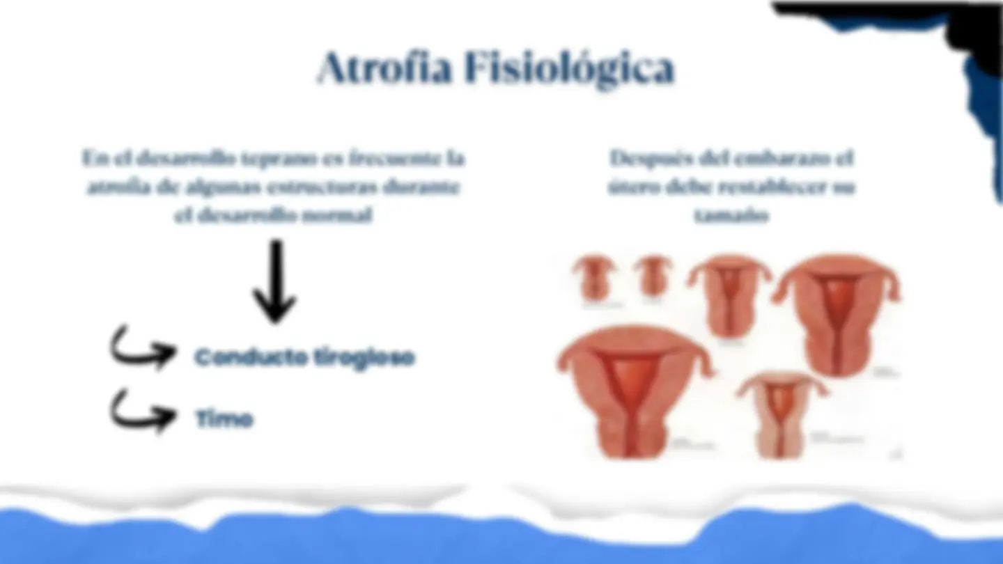 pfa