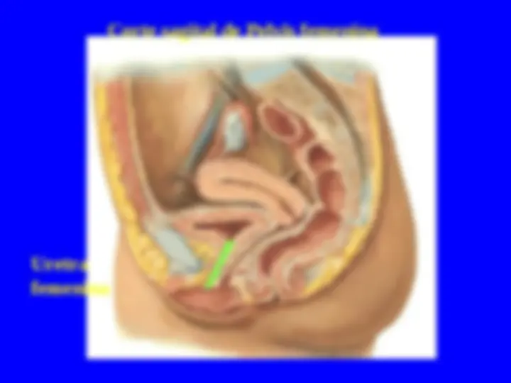 pf23