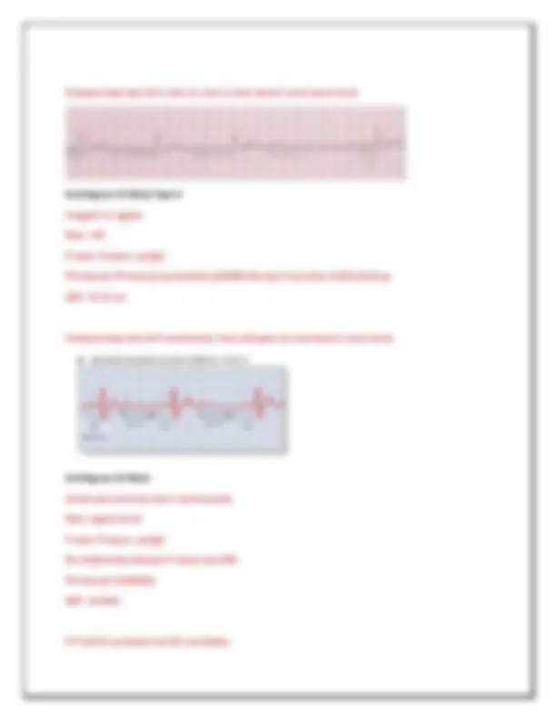 Cardiac Dysrhythmia Quick Reference Guide: ECG Interpretation | Exams ...