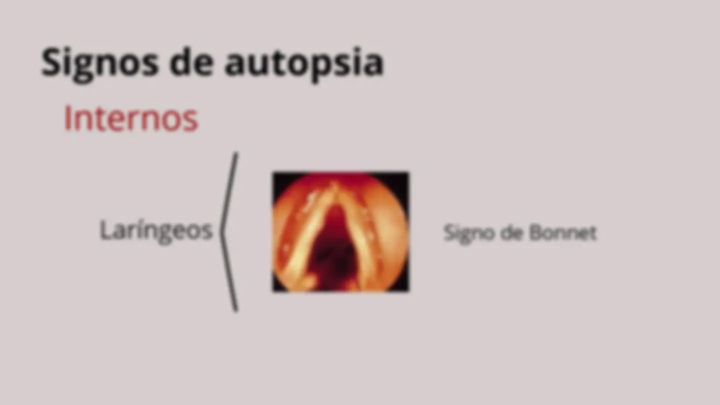 pfe