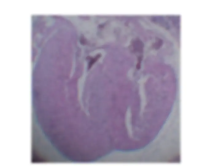 pf1a
