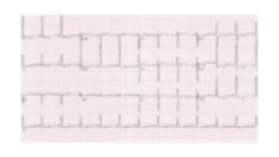 pf3