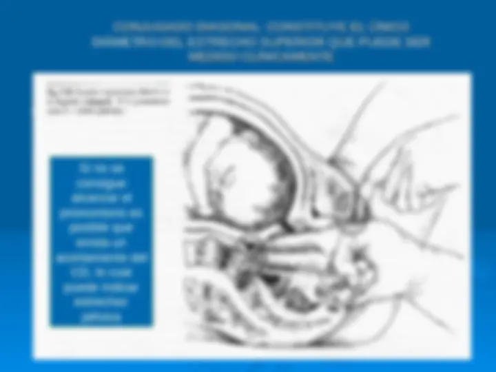 pf2c