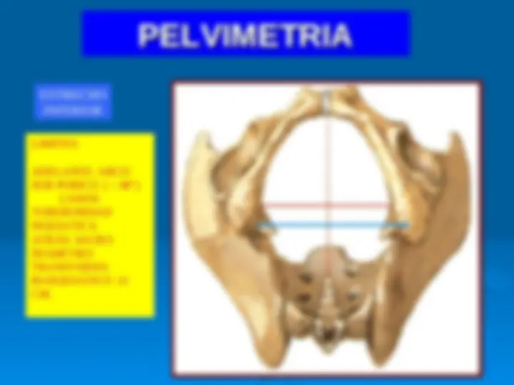pf28
