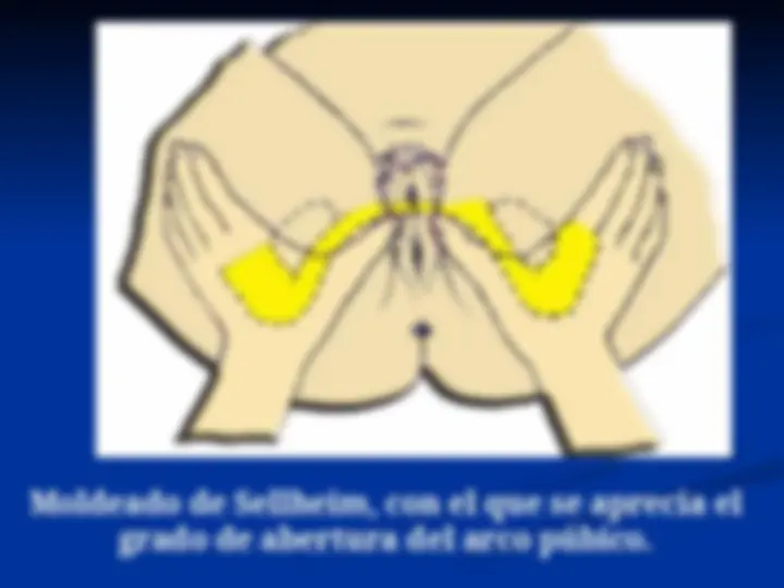 pf32