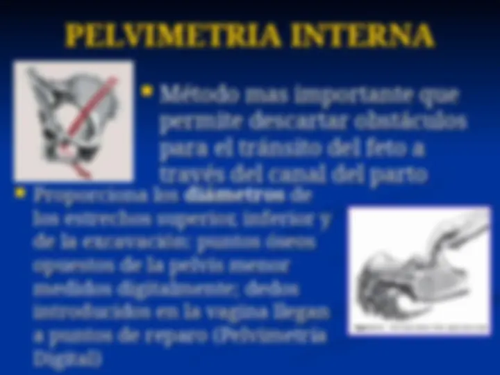 pf33
