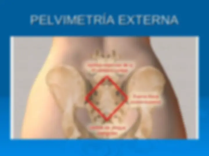pf21