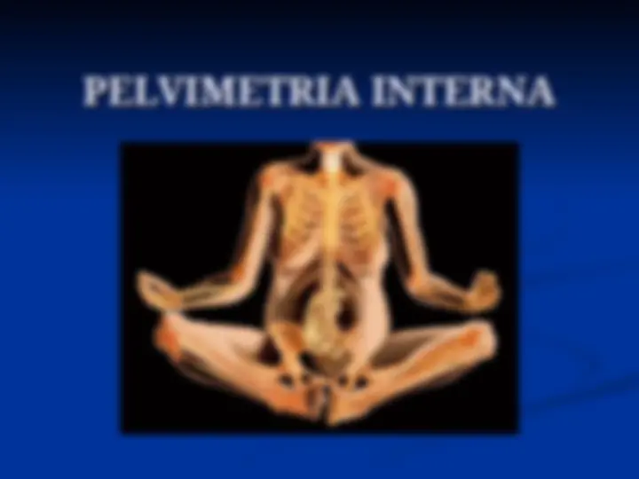 pf24