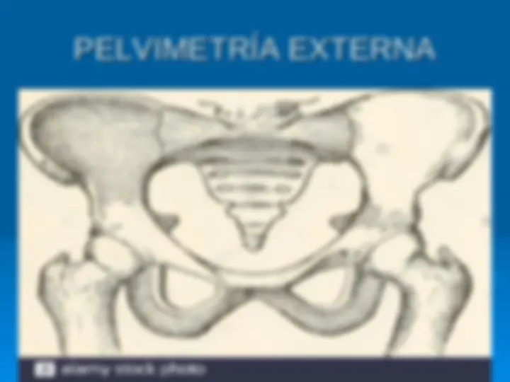 pf1e