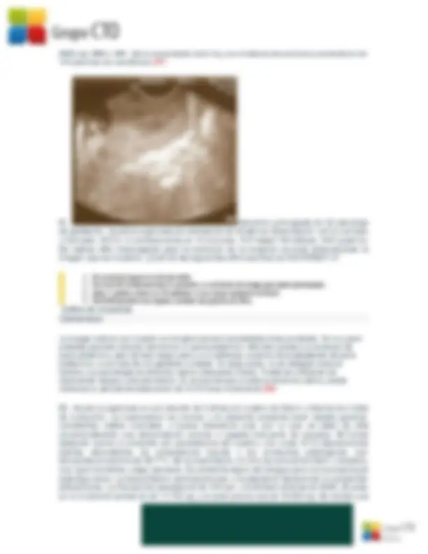 pf24