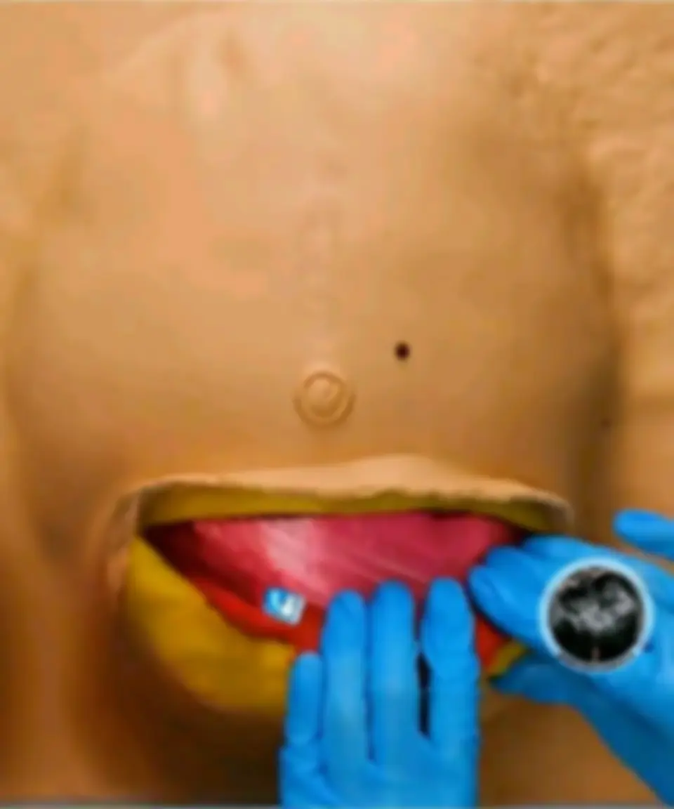 pfa