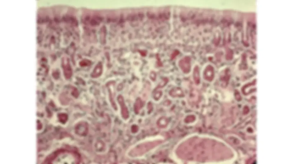 pf1a