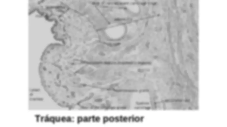 pf3b