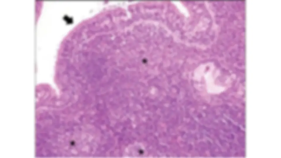 pf22