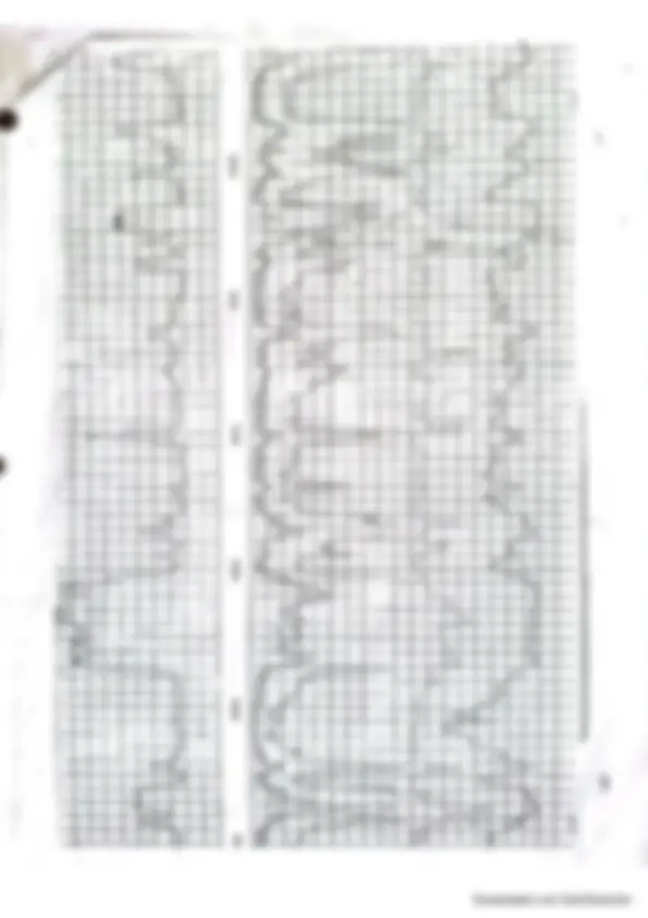 pf8