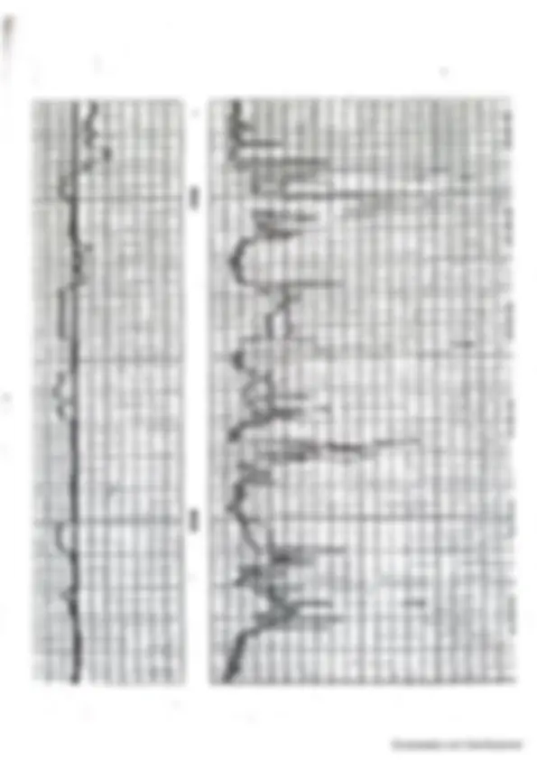 pf4