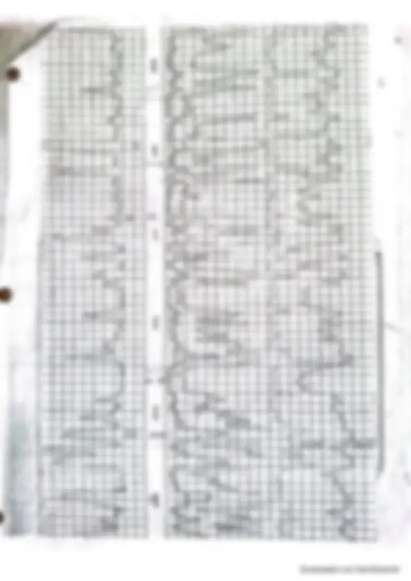 pfa