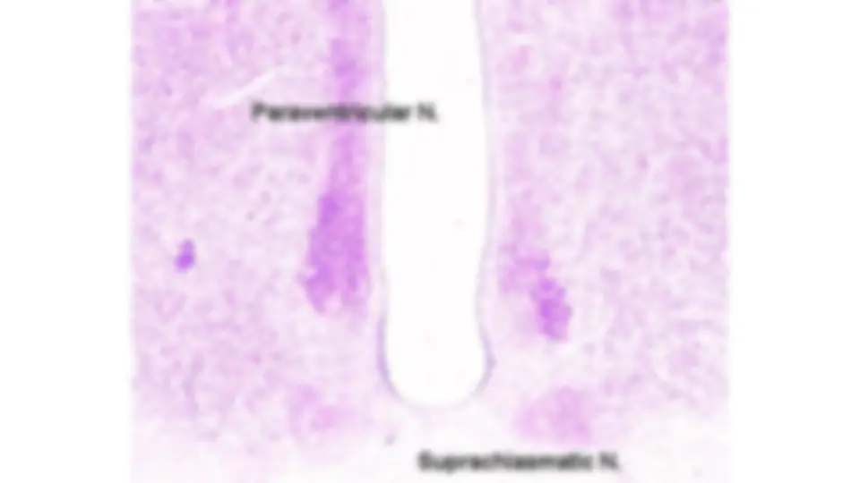 pf5