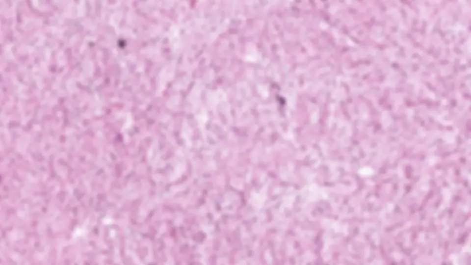 pf2a