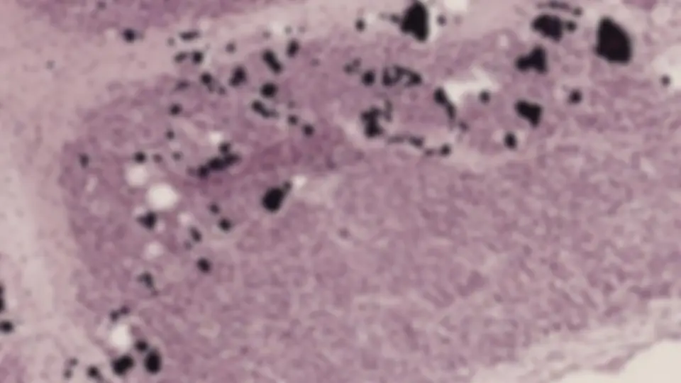 pf34
