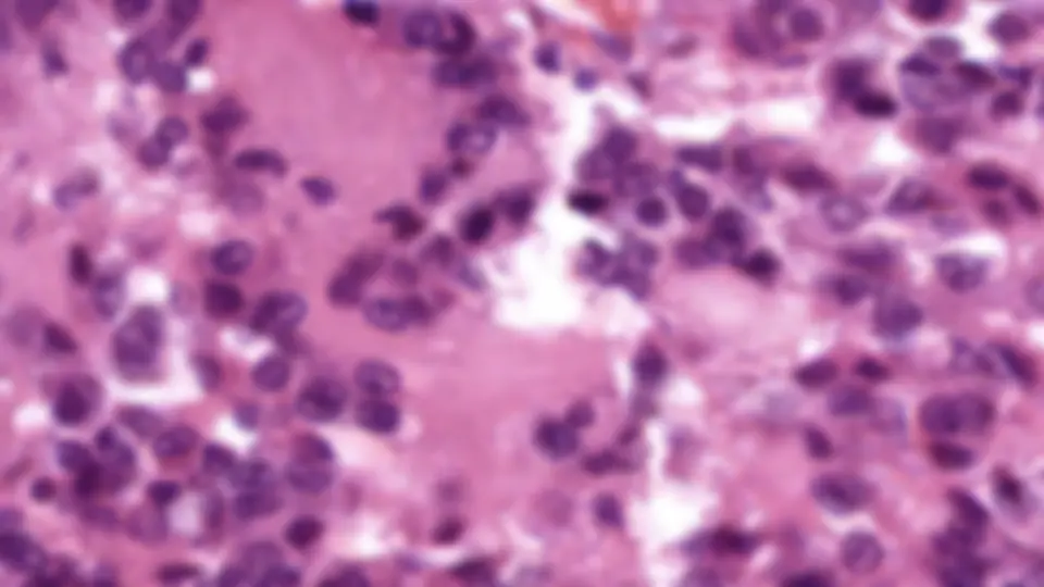 pf1b