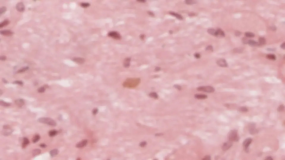 pf24