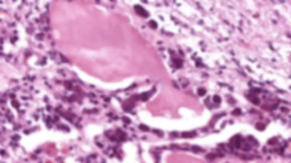 pf19