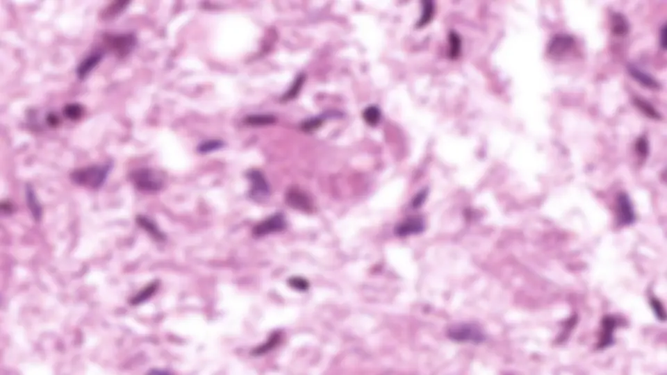 pf2c