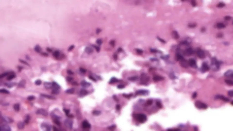 pf1a