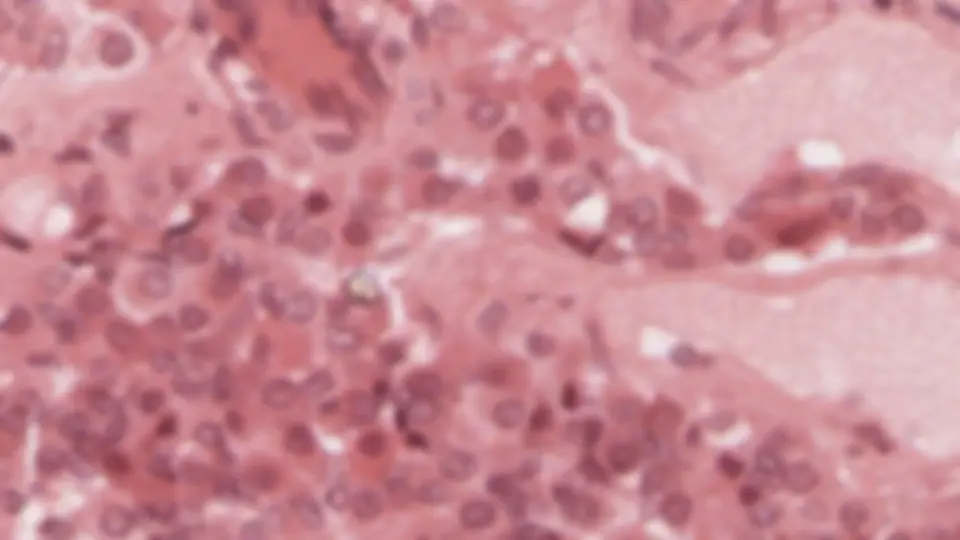 pf1f